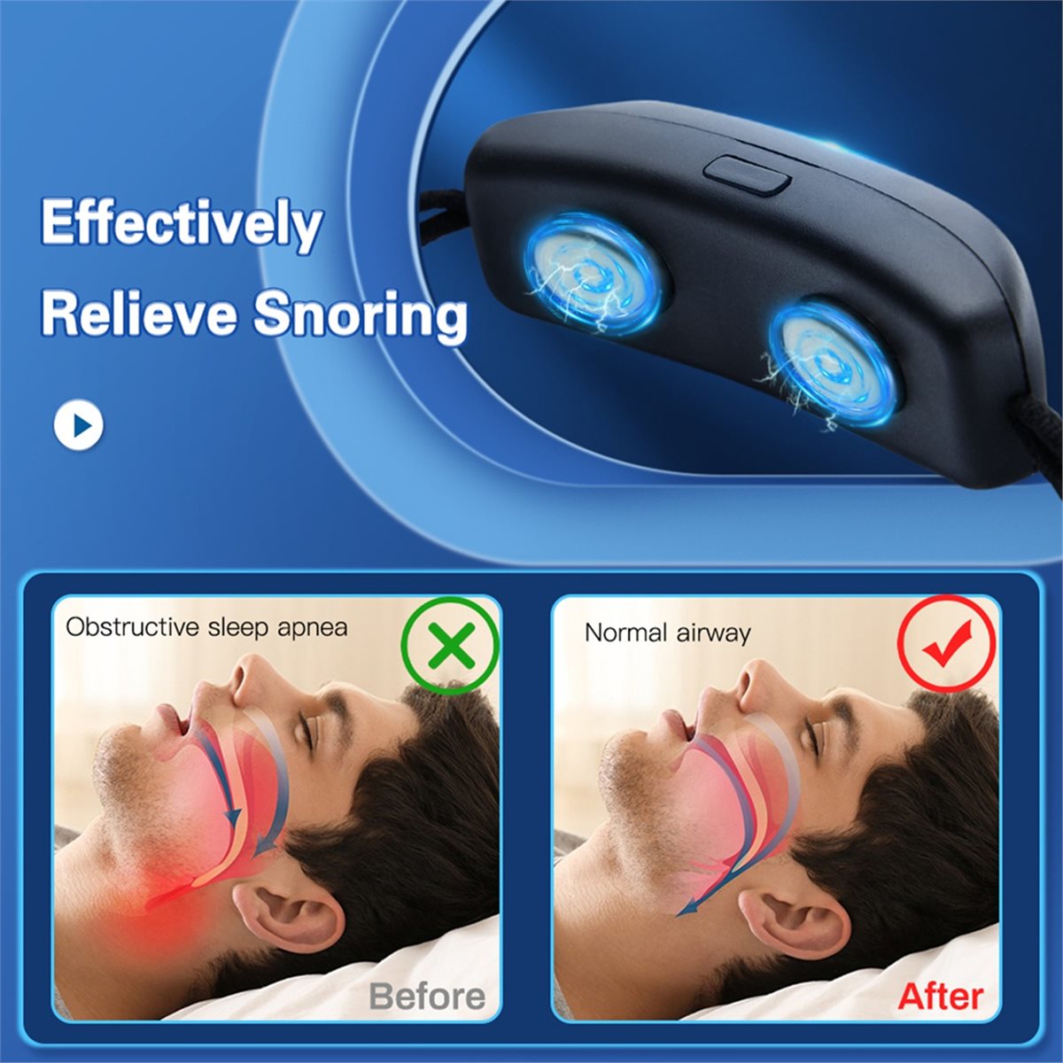 Health Wellness Trends - 2026 Trend EMS Pulse Stop Snore